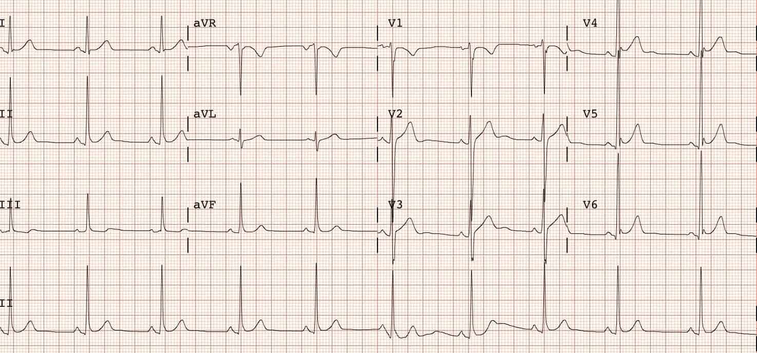 Blog 10 cuanto vale un electrocardiograma