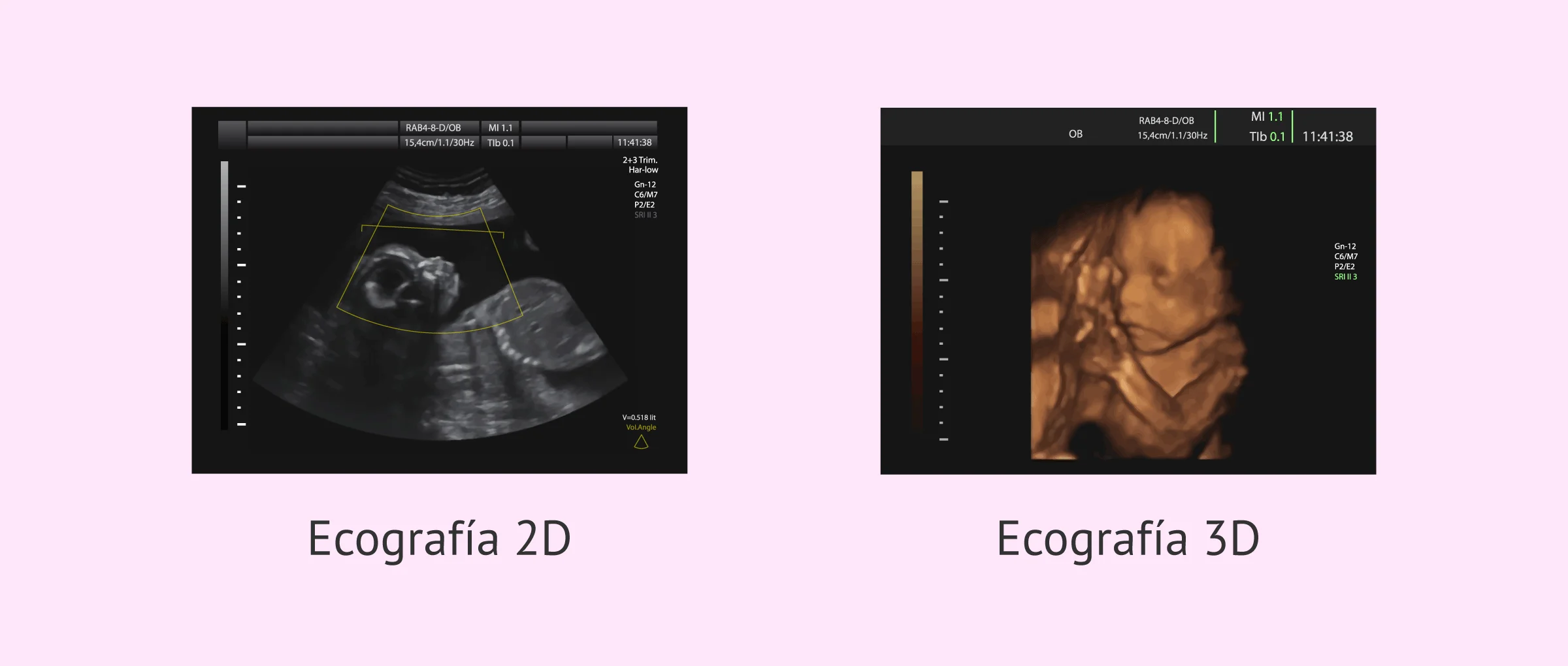 cuanto vale una ecografia