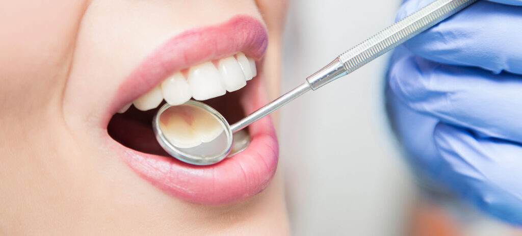 cuanto vale una limpieza dental
