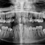 cuanto-vale-una-radiografia-panoramica