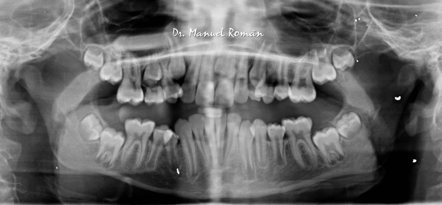 Blog 6 cuanto vale una radiografia panoramica