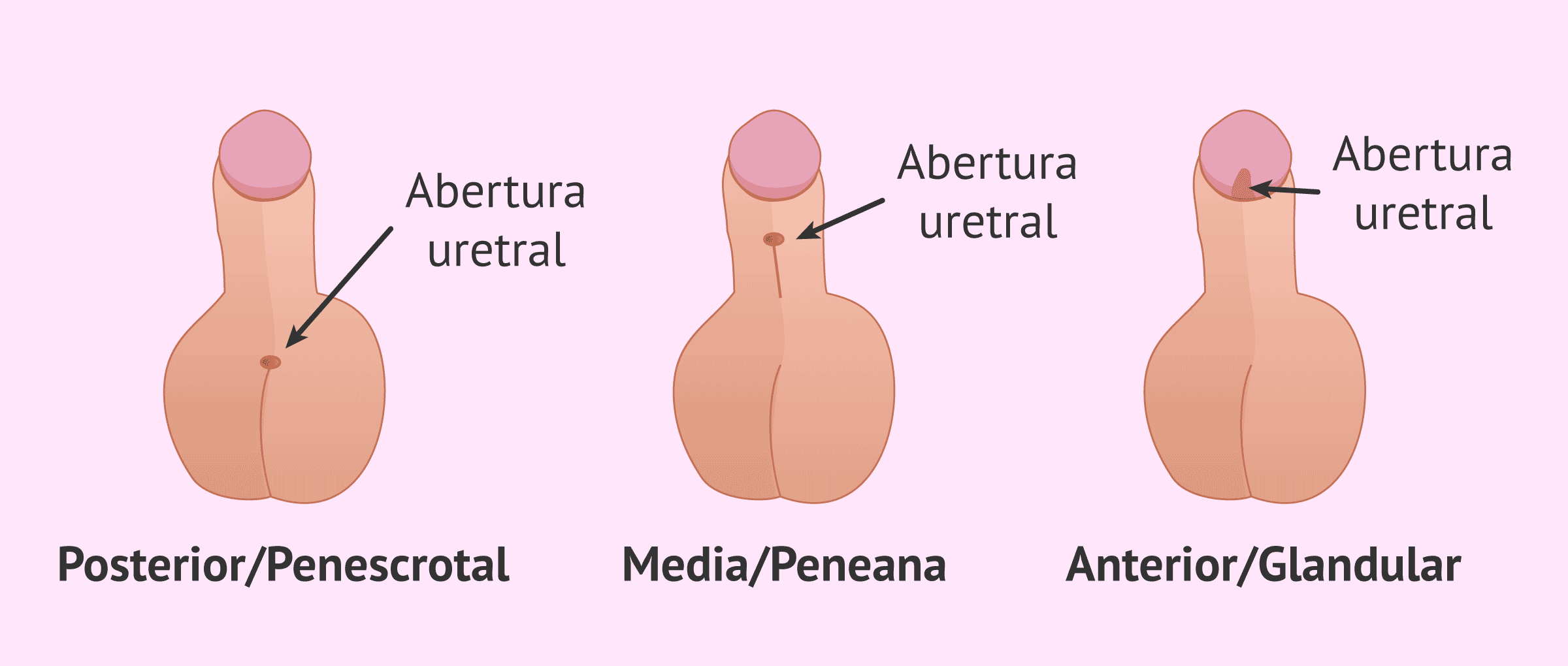 Blog 4 cuantos hoyos tiene la mujer