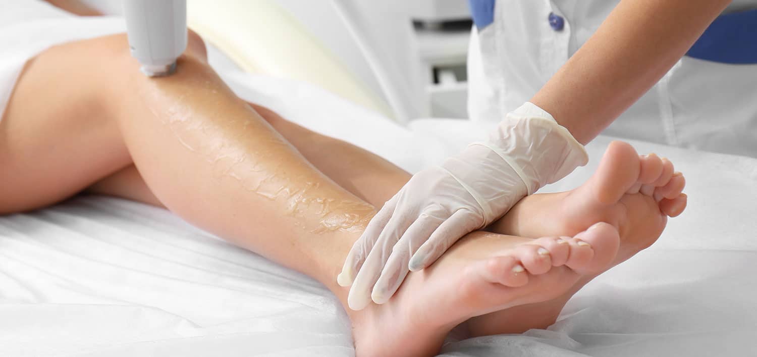 depilacion laser bigote cuantas sesiones
