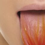 lengua-quemada-cuanto-dura