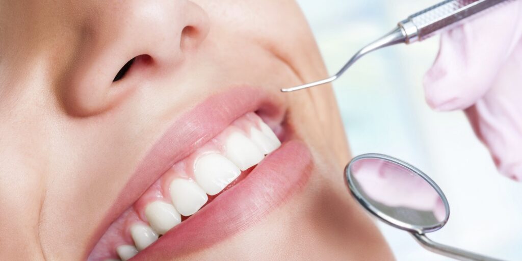 limpieza dental cada cuanto