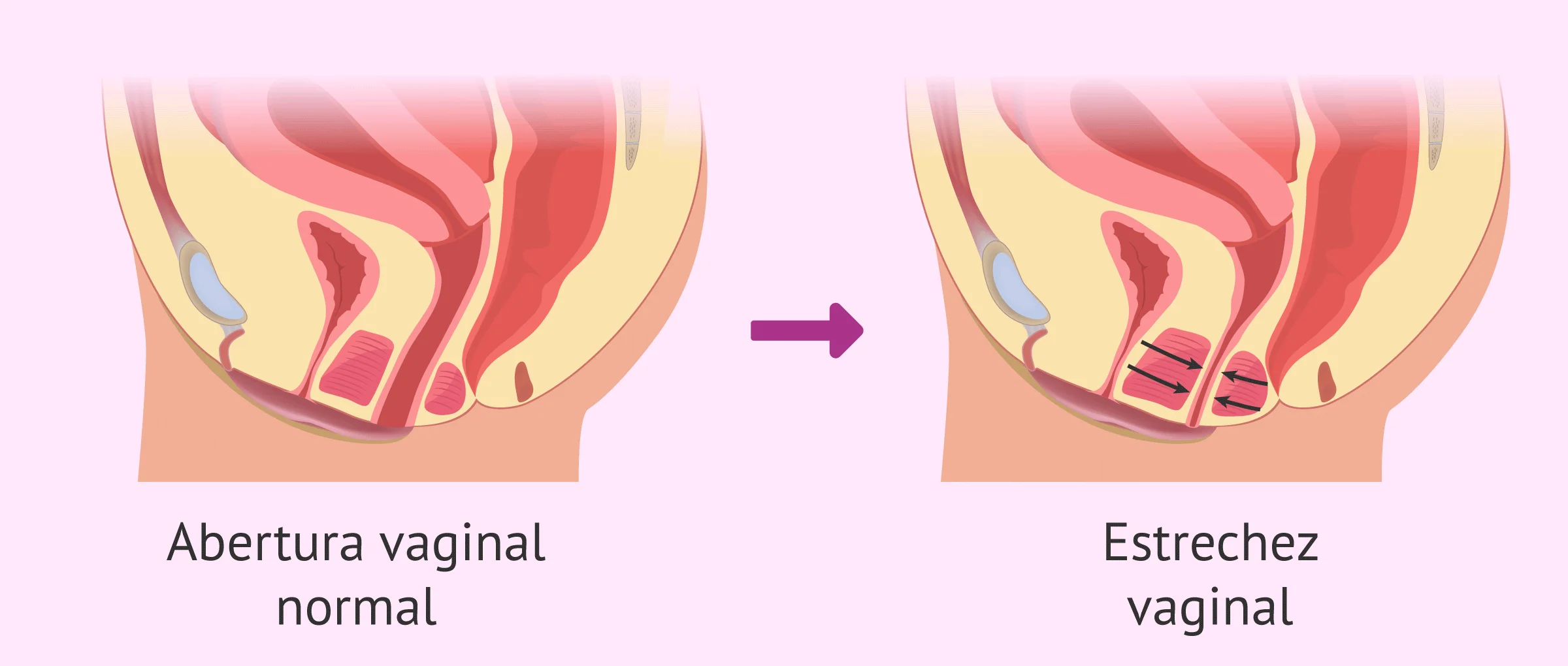 mujeres virgenes cuanto cobran