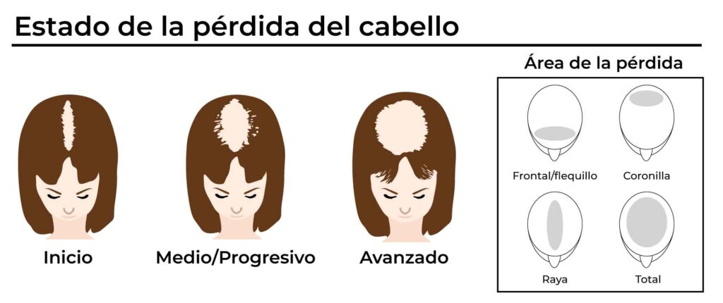 protesis capilar cuanto dura