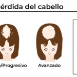 protesis-capilar-cuanto-dura